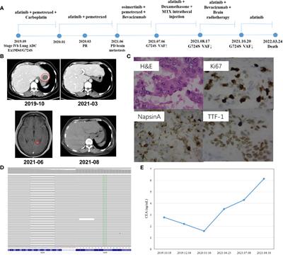 NSCLC patients with rare EGFR Ex19del/G724S mutation showed good response to afatinib combined with chemotherapy treatment: A two-case report